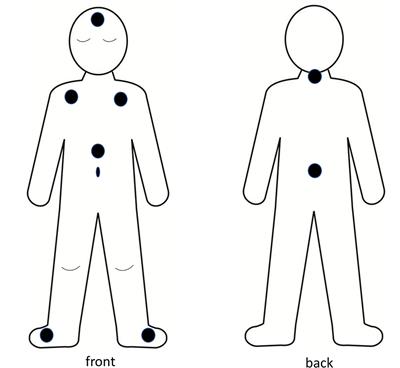 Skin Temperatures of Back or Neck Are Better Than Abdomen for Indication of Average Proximal Skin Temperature During Sleep of School-Aged Children